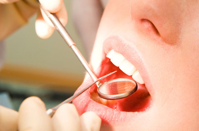 Cheques dentista para rastreio de cancro oral